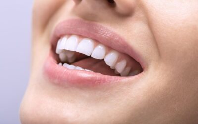 Białe plamy na zębach – czym są i jak z nimi walczyć?